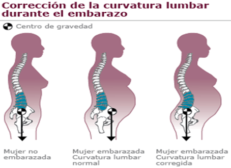 Curvatura lumbar en el embarazo