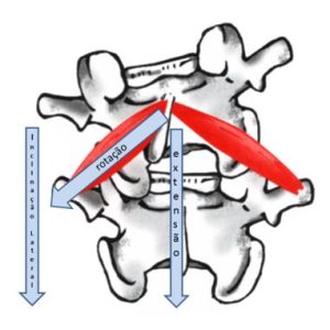 escoliose-4-dimesao-cranio-caudal.jpg escoliose-4-dimesao-cranio-caudal.jpg